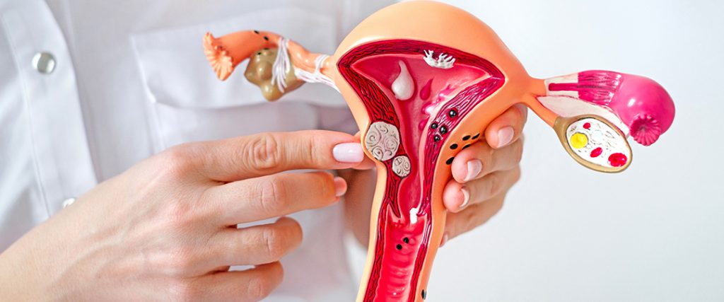  Fibroid Surgery Specialist in Kolkata India