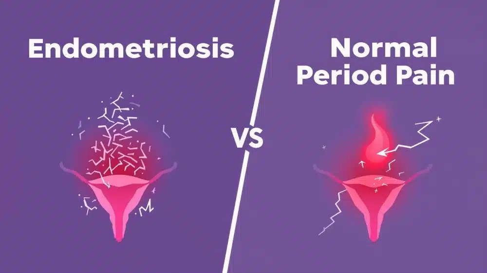 Period Pain vs Endometriosis